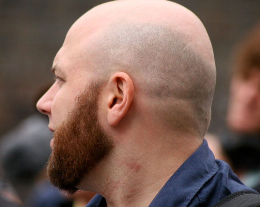 Bald man.